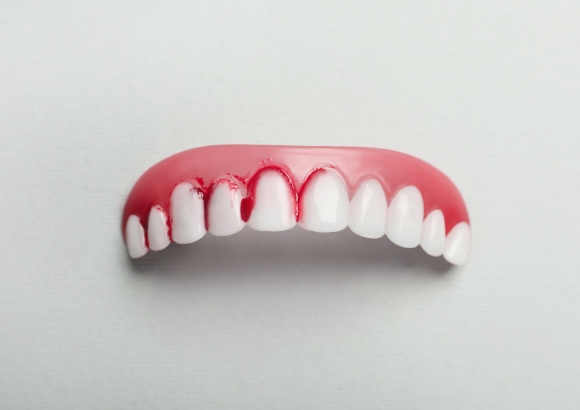 gingivitis treatment gingivitis treatment